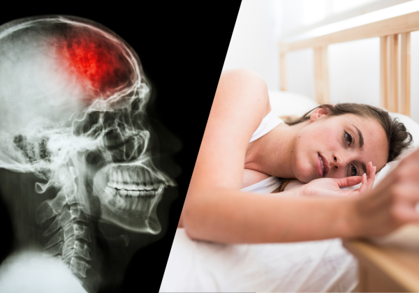 una persona con insomnio, más radiografia de una persona sufiriendo un ACV.